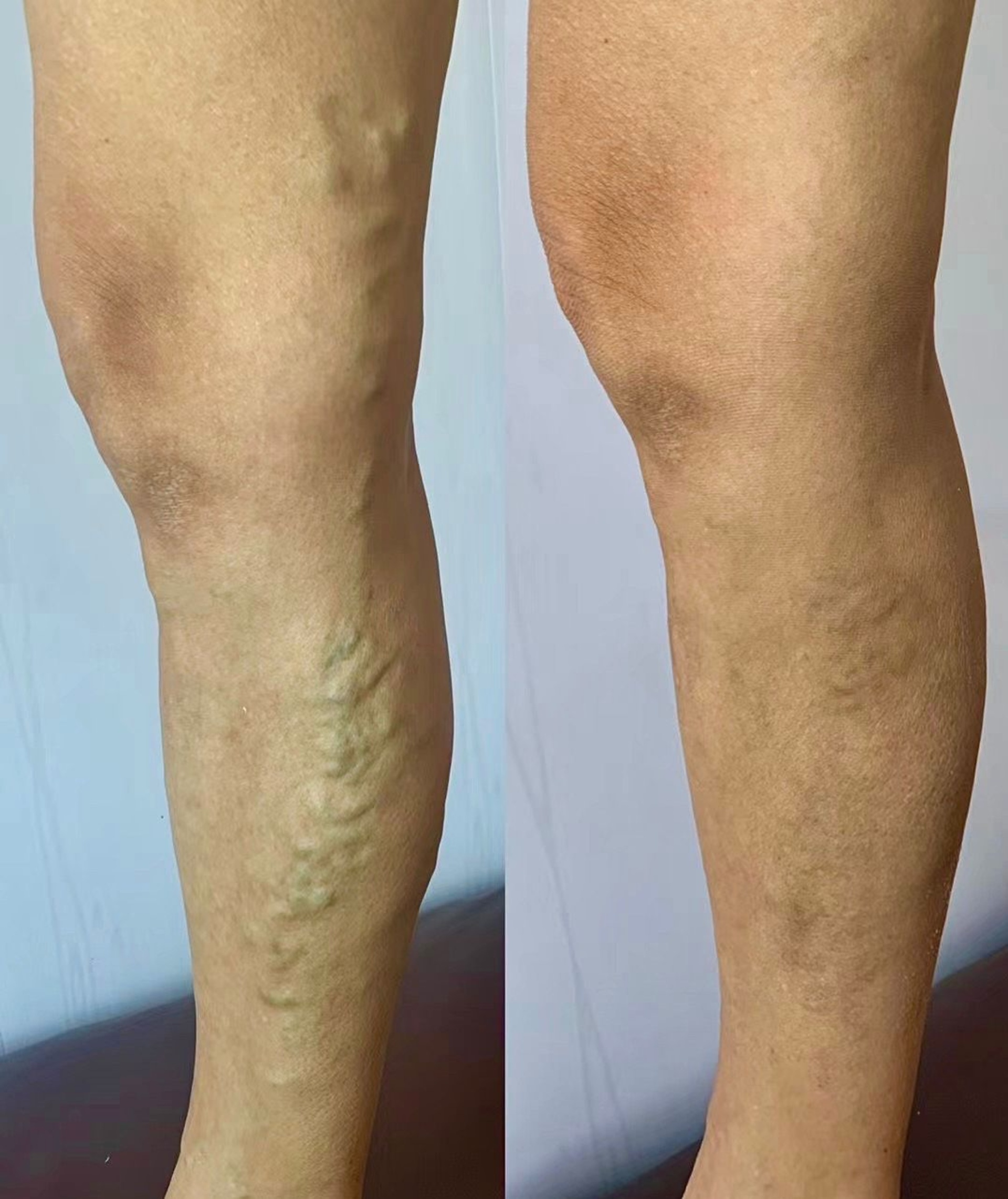 Трусикидегі жетілген әйелдер порно