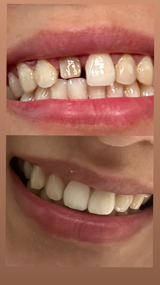 Қазір онлайнда Skype секс