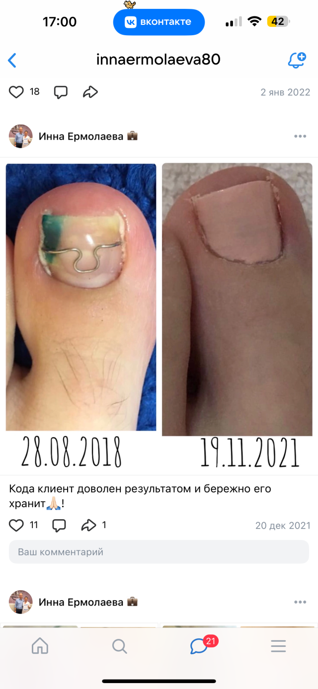 МАЛЕНькая пися ДОЧКИ Отзывы о Gehwol, студия, проспект Карла Маркса, 134, Магнитогорск - 2ГИС