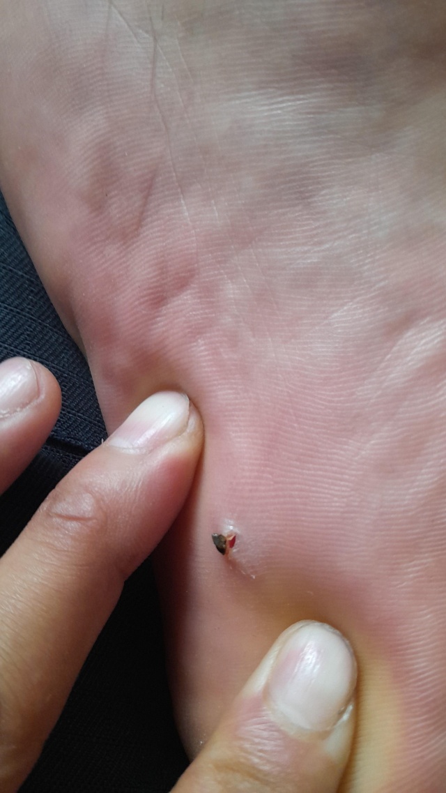 Аяғы жоқ қызды бля