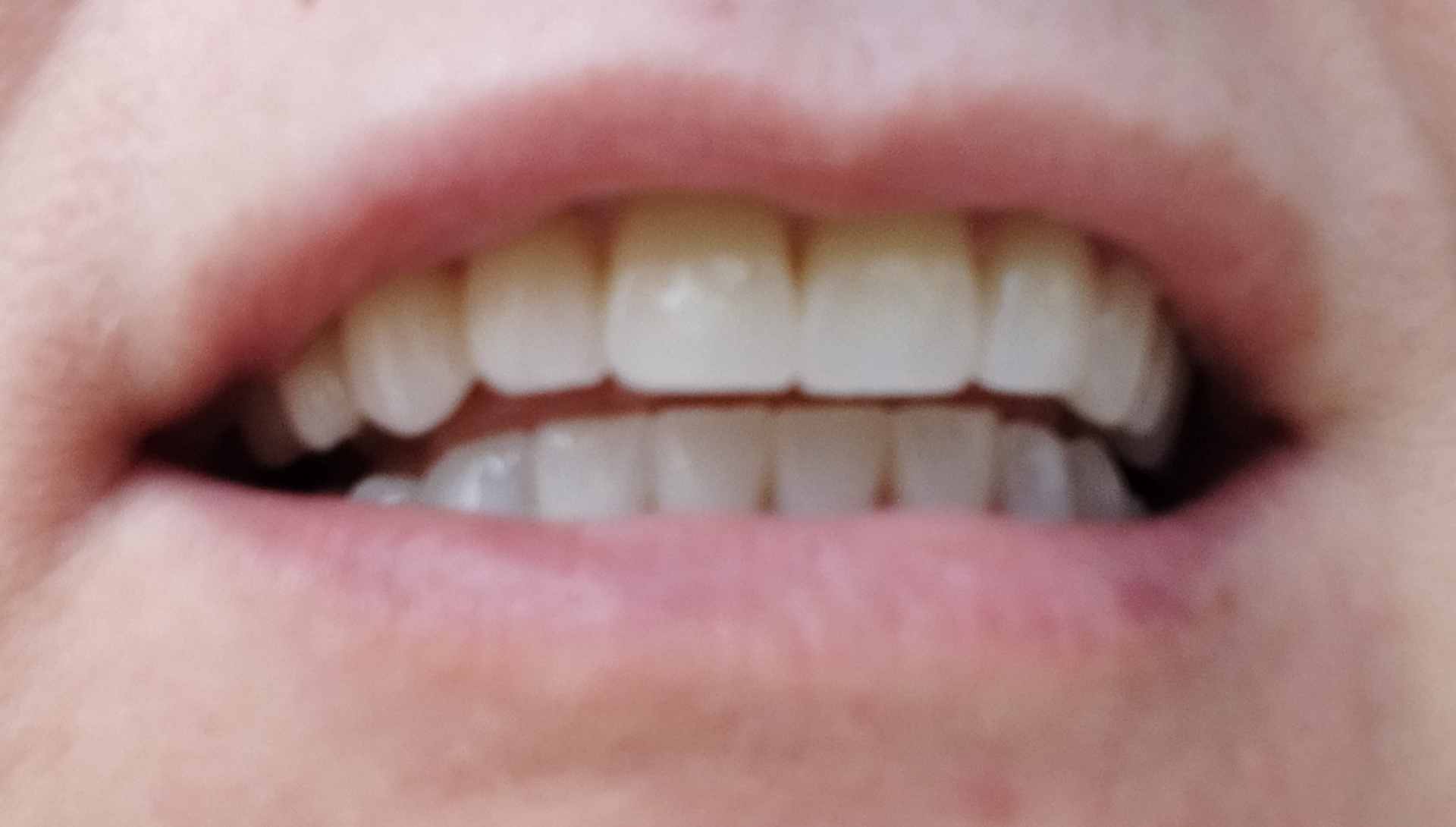 Smile dent, стоматологическая клиника, 5-й микрорайон, 1, Курган — 2ГИС